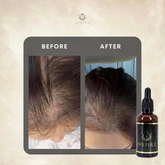 Inspire Hair Growth Tonic. Hair Growth within in 3 Weeks. main image 8